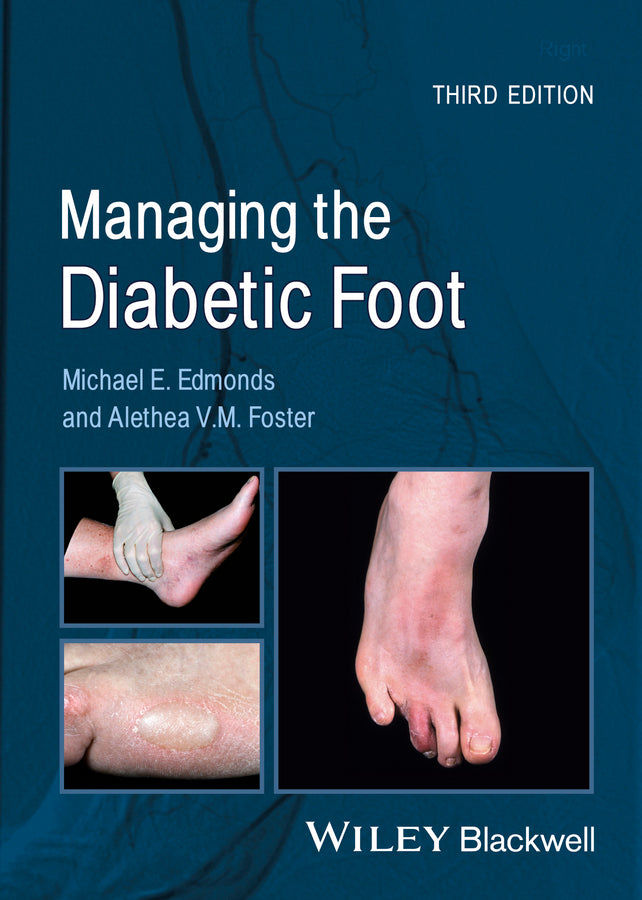 Managing the Diabetic Foot 3e (Paperback / softback) 9780470655054