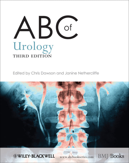 ABC of Urology 3e (Paperback / softback) 9780470657171