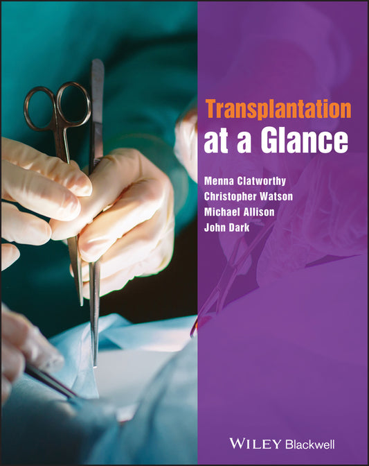 Transplantation at a Glance (Paperback / softback) 9780470658420