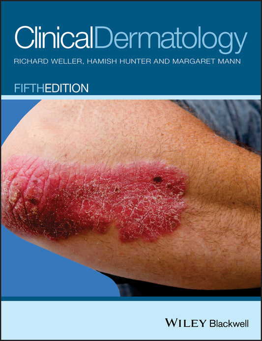 Clinical Dermatology 5e (Paperback / softback) 9780470659526