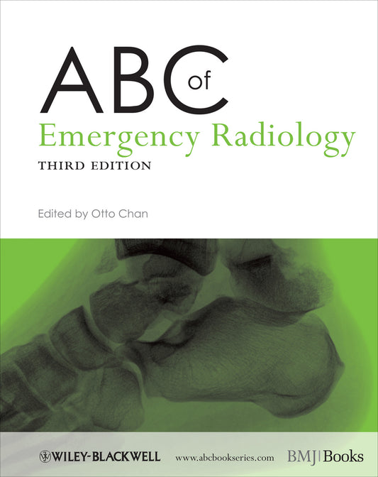 ABC of Emergency Radiology 3e (Paperback / softback) 9780470670934