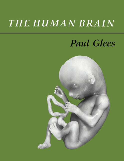 The Human Brain (Paperback) 9780521017817