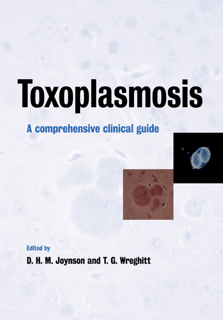 Toxoplasmosis; A Comprehensive Clinical Guide (Paperback) 9780521019422