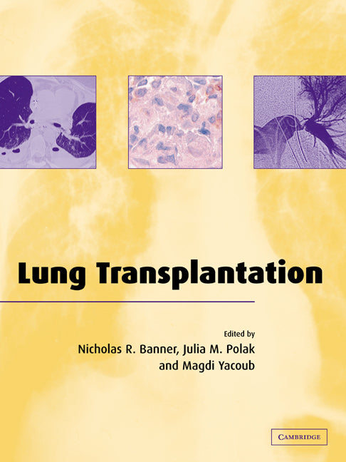 Lung Transplantation (Paperback / softback) 9780521036771