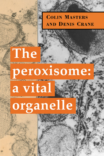 The Peroxisome; A Vital Organelle (Paperback / softback) 9780521036832
