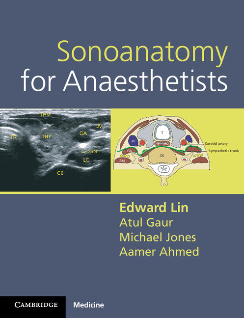 Sonoanatomy for Anaesthetists (Spiral bound) 9780521106665