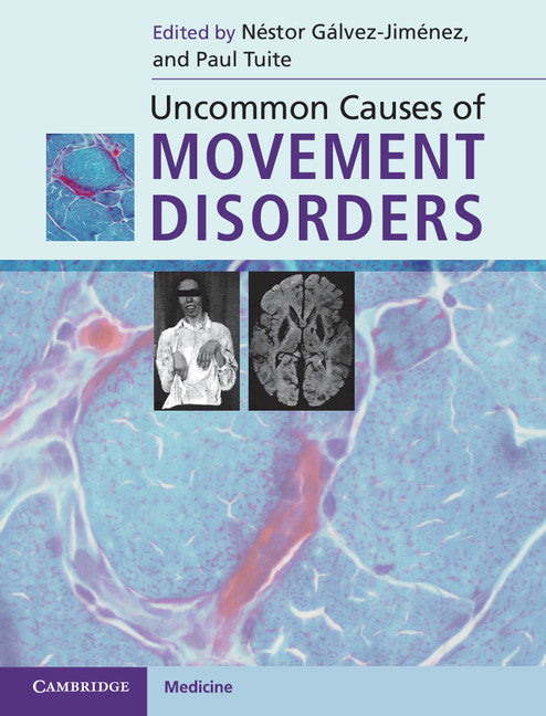 Uncommon Causes of Movement Disorders (Hardback) 9780521111546