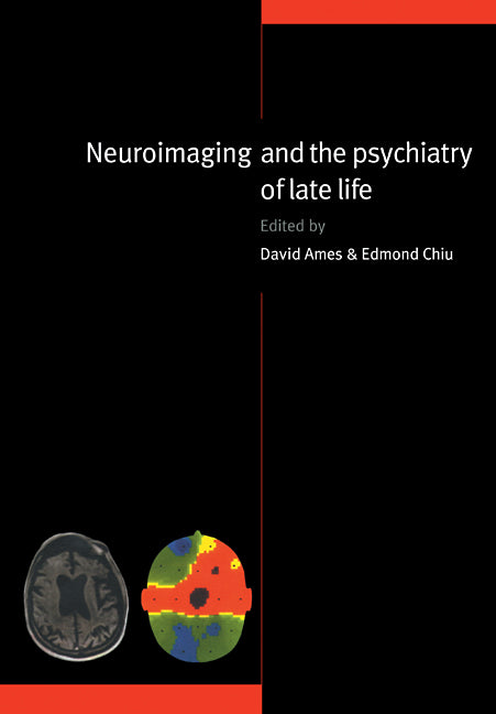 Neuroimaging and the Psychiatry of Late Life (Paperback) 9780521112475