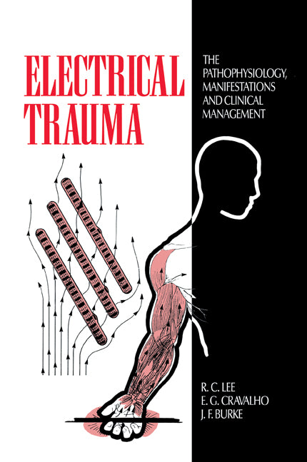 Electrical Trauma; The Pathophysiology, Manifestations and Clinical Management (Paperback) 9780521116145