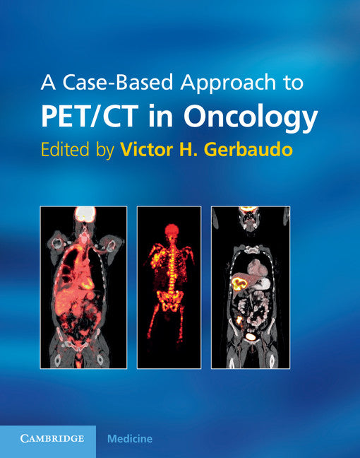 A Case-Based Approach to PET/CT in Oncology (Hardback) 9780521116831