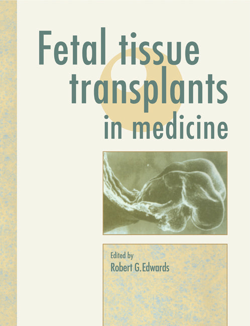 Fetal Tissue Transplants in Medicine (Paperback) 9780521116923