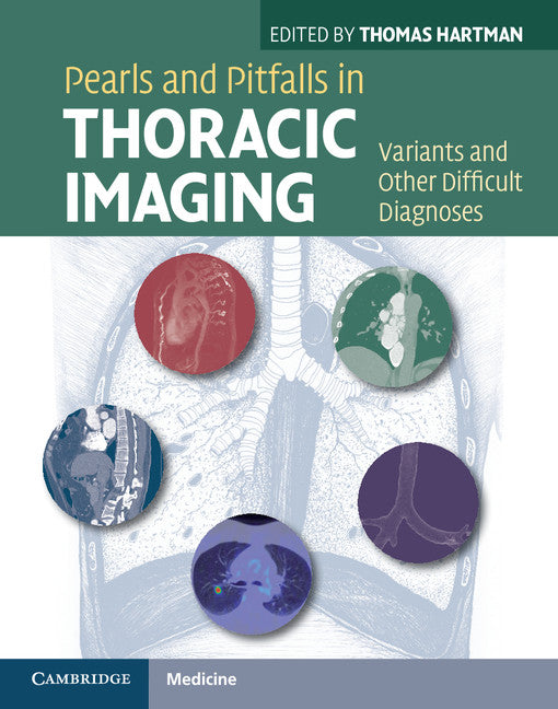 Pearls and Pitfalls in Thoracic Imaging; Variants and Other Difficult Diagnoses (Hardback) 9780521119078