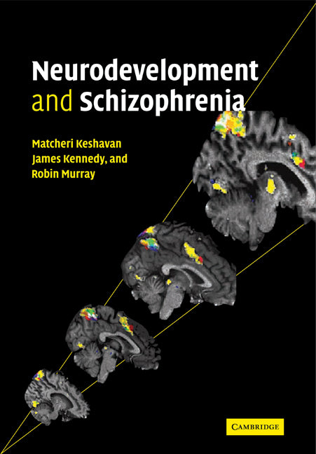 Neurodevelopment and Schizophrenia (Paperback) 9780521126595