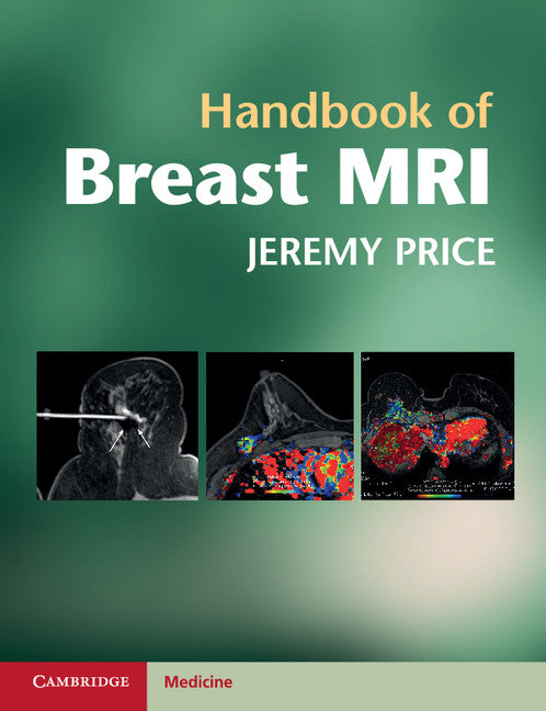 Handbook of Breast MRI (Paperback) 9780521139663