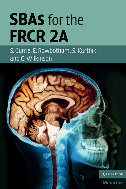 SBAs for the FRCR 2A (Paperback) 9780521156448