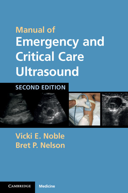 Manual of Emergency and Critical Care Ultrasound (Paperback) 9780521170918