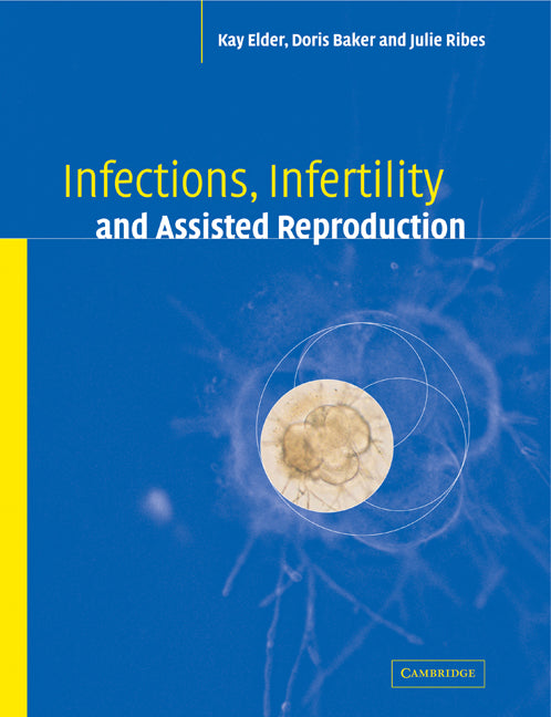 Infections, Infertility, and Assisted Reproduction (Paperback) 9780521178518