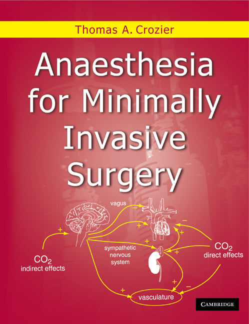 Anaesthesia for Minimally Invasive Surgery (Paperback) 9780521179775