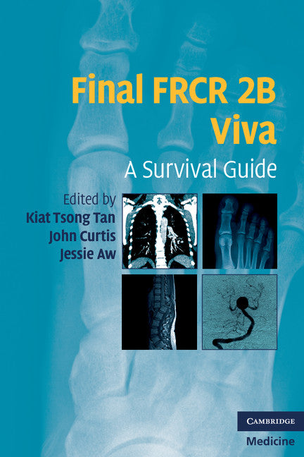 Final FRCR 2B Viva; A Survival Guide (Paperback) 9780521183079