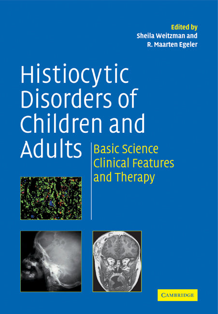 Histiocytic Disorders of Children and Adults; Basic Science, Clinical Features and Therapy (Paperback) 9780521184168