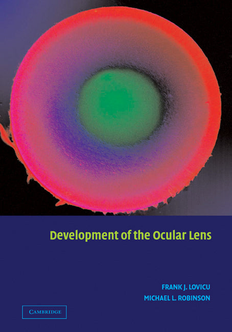 Development of the Ocular Lens (Paperback) 9780521184236