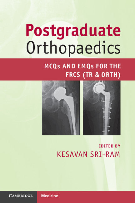 Postgraduate Orthopaedics; MCQs and EMQs for the FRCS (Tr & Orth) (Paperback) 9780521184717