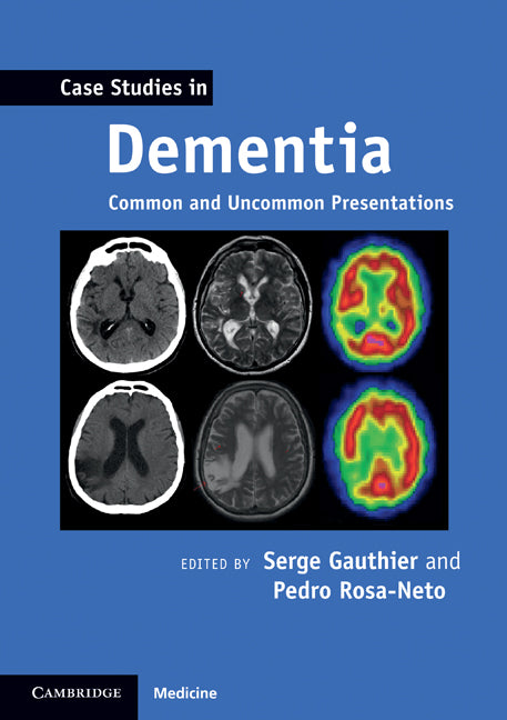 Case Studies in Dementia: Volume 1; Common and Uncommon Presentations (Paperback) 9780521188302