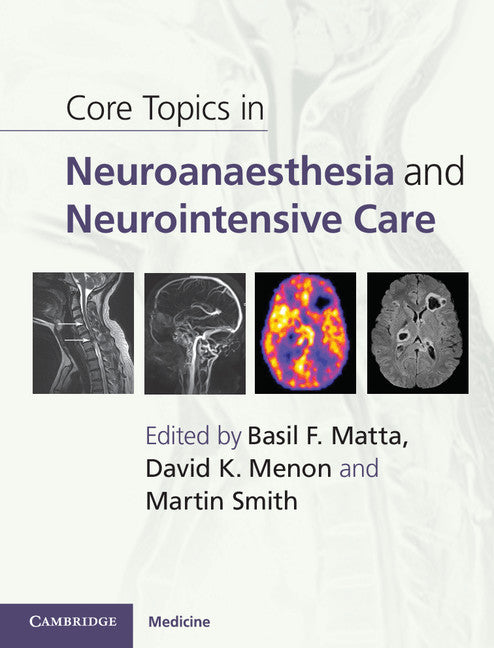 Core Topics in Neuroanaesthesia and Neurointensive Care (Hardback) 9780521190572