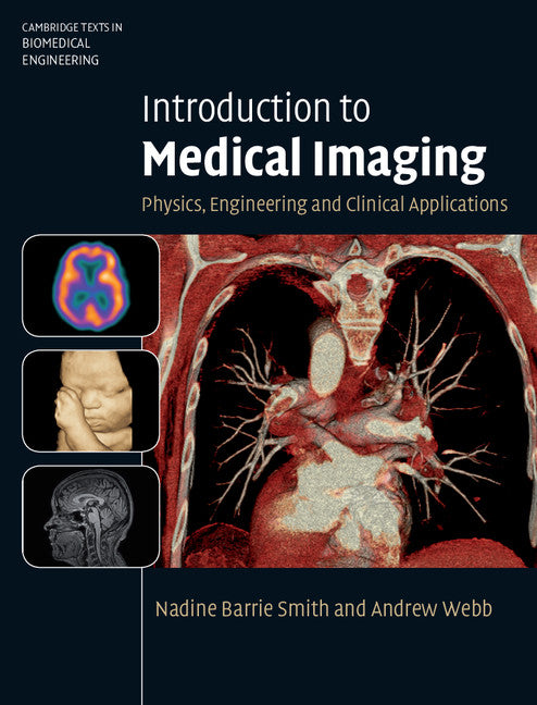 Introduction to Medical Imaging; Physics, Engineering and Clinical Applications (Hardback) 9780521190657