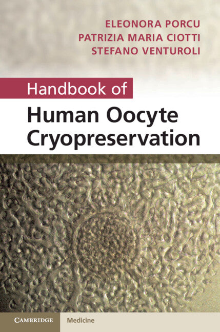Handbook of Human Oocyte Cryopreservation (Hardback) 9780521192392