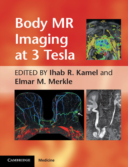 Body MR Imaging at 3 Tesla (Hardback) 9780521194860