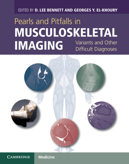 Pearls and Pitfalls in Musculoskeletal Imaging; Variants and Other Difficult Diagnoses (Hardback) 9780521196321