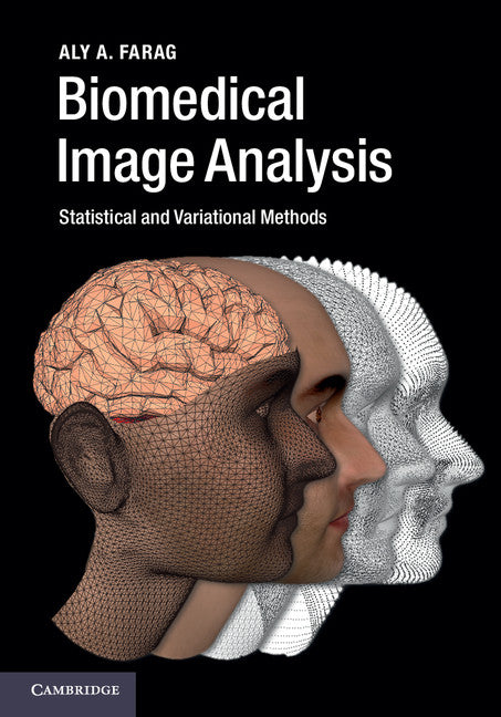 Biomedical Image Analysis; Statistical and Variational Methods (Hardback) 9780521196796