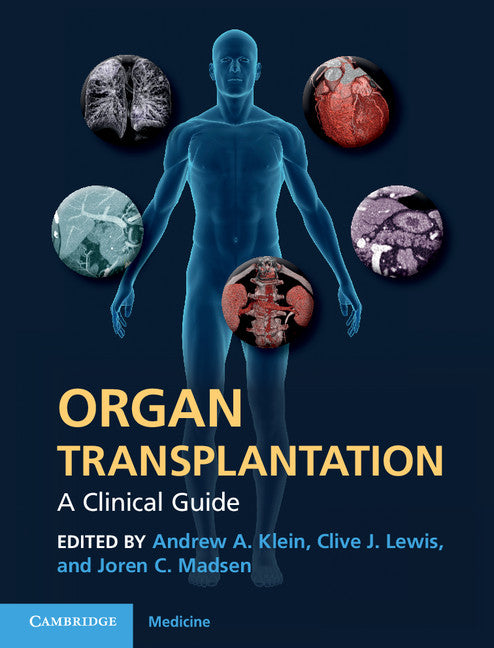 Organ Transplantation; A Clinical Guide (Hardback) 9780521197533