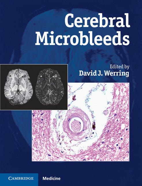 Cerebral Microbleeds; Pathophysiology to Clinical Practice (Hardback) 9780521198455