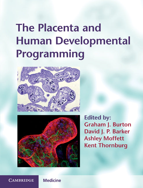 The Placenta and Human Developmental Programming (Hardback) 9780521199452