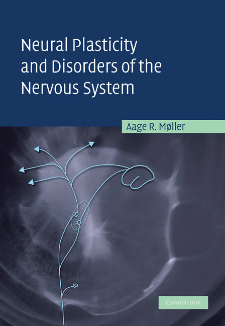 Neural Plasticity and Disorders of the Nervous System (Paperback) 9780521248952