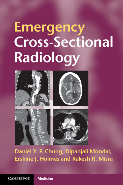 Emergency Cross-sectional Radiology (Paperback) 9780521279536