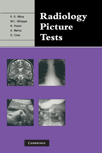 Radiology Picture Tests; Film Viewing and Interpretation for Part 1 FRCR (Paperback) 9780521280891