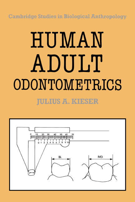 Human Adult Odontometrics; The Study of Variation in Adult Tooth Size (Hardback) 9780521353908