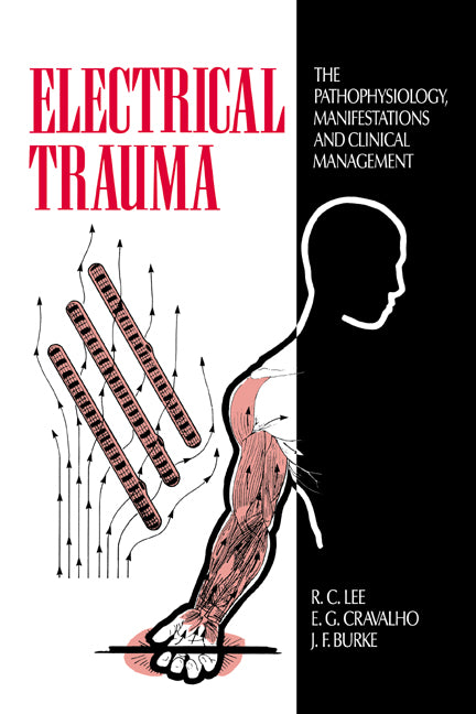 Electrical Trauma; The Pathophysiology, Manifestations and Clinical Management (Hardback) 9780521383455