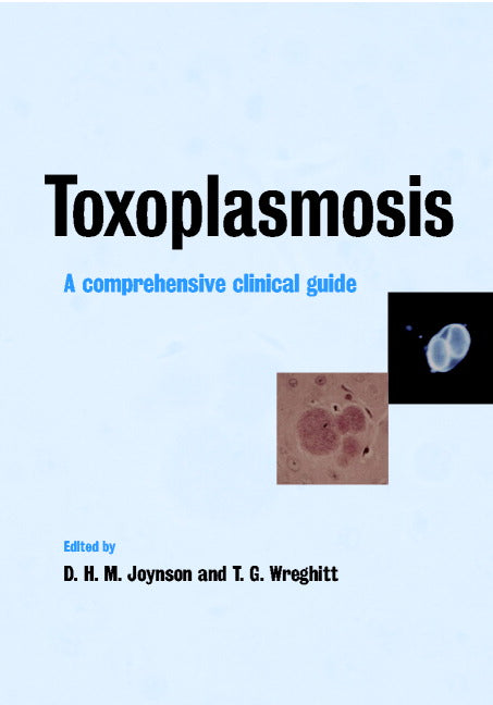 Toxoplasmosis; A Comprehensive Clinical Guide (Hardback) 9780521443289