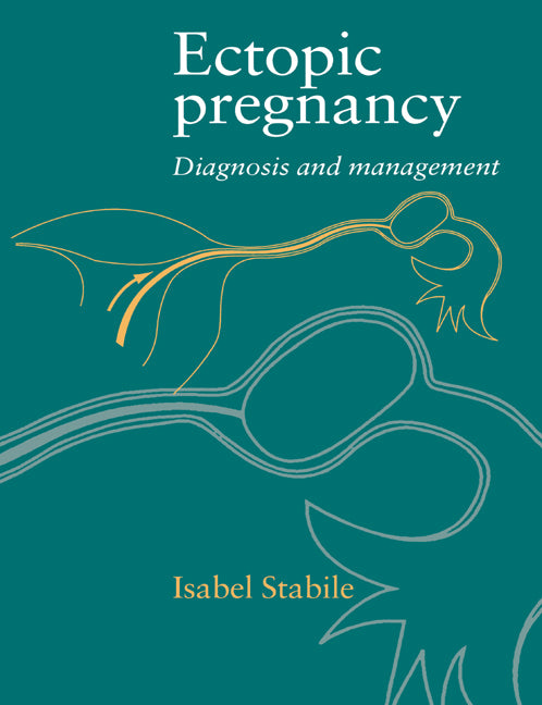 Ectopic Pregnancy; Diagnosis and Management (Paperback) 9780521496124