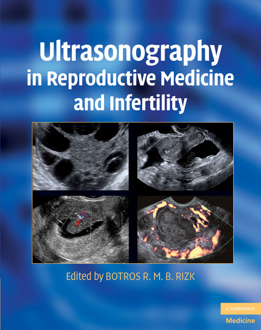 Ultrasonography in Reproductive Medicine and Infertility (Hardback) 9780521509763