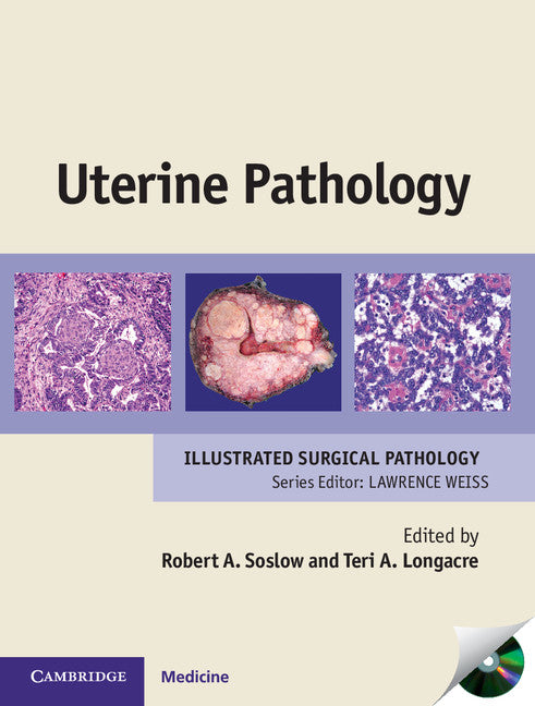 Uterine Pathology (Hardback) 9780521509800