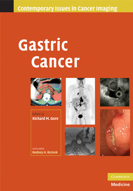 Gastric Cancer (Hardback) 9780521513838