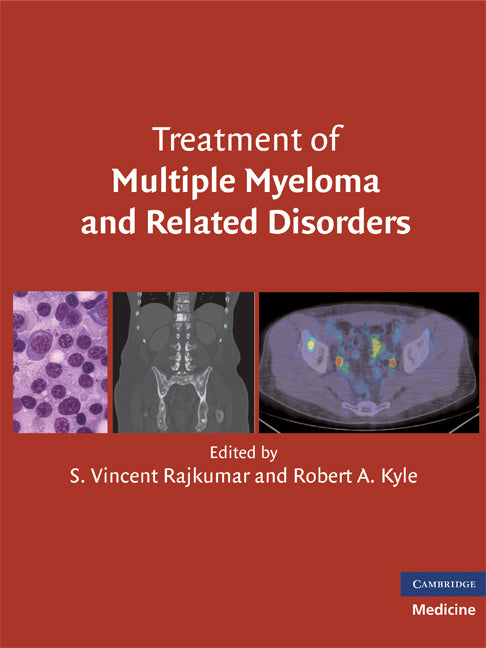 Treatment of Multiple Myeloma and Related Disorders (Hardback) 9780521515030