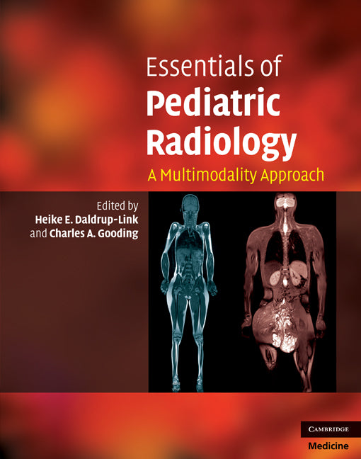 Essentials of Pediatric Radiology; A Multimodality Approach (Hardback) 9780521515214