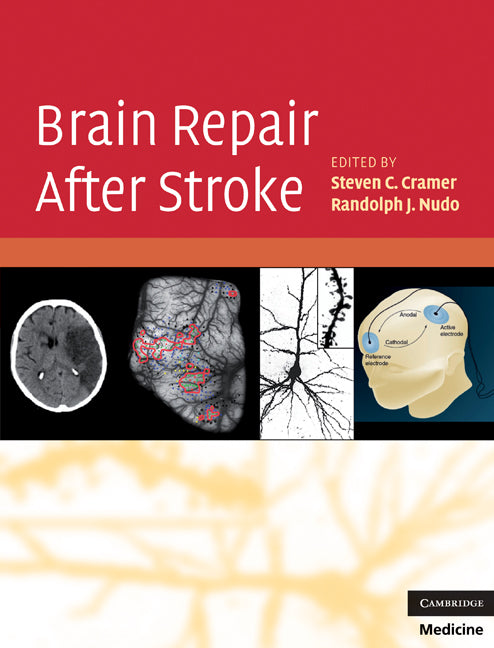 Brain Repair After Stroke (Hardback) 9780521515337