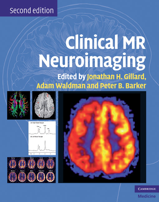 Clinical MR Neuroimaging; Physiological and Functional Techniques (Hardback) 9780521515634